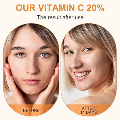 Premium 20% Vitamin C Serum For Face with Hyaluronic Acid, Retinol & Amino Acids